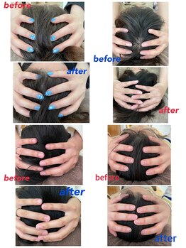 アールプラス(R+)/脳疲労眼精疲労ケア