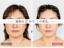 真美(Sinbi)の雰囲気（骨格から整えて、顔の歪み・たるみ・エラ張りをすっきり！！）