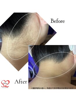 オリオンドットエスツー(Orion.S2)/【Before→After】