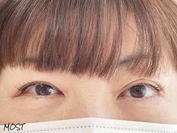 モスト(MOST)/★35歳からのまつエク/1★