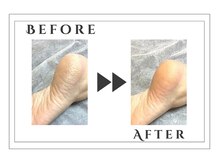 アルゴ 志免店(ALGO)/スクラブでツルスベ肌♪