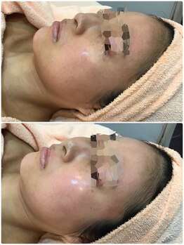 アンシャンテ(En chan te)/カーボキシー