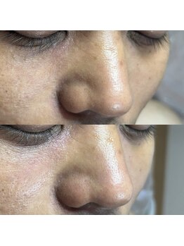 シャイニー(SHINY)/30代男性