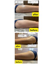 サロン イフ(salon if)/専用機器にて筋膜リリース