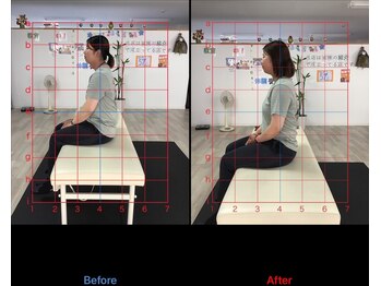 ストレチックス 近江八幡店/BeforeAfter