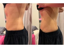 ブリア 横浜(BRILLA)/美腸＝美肌＝美ボディ