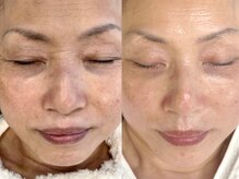 ビタザボナ(Vita the Bona)の雰囲気（話題の幹細胞で結果重視のエイジングケア）