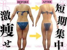 エストビューティー 池袋店(EST BEAUTY)/当サロン自慢の技術【池袋痩身】