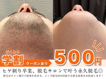 ボス 大曽根店(BOSS)の雰囲気（最短期間で脱毛完了＃シェービング＃ヒゲ脱毛＃メンズ脱毛）