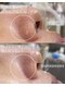 アイラッシュユーリ(Eyelash Juli)の写真/お顔のワックス脱毛でうぶ毛オフ！驚きのトーンアップ◎「ちゅるん」と輝く、加工いらずの素肌へ。
