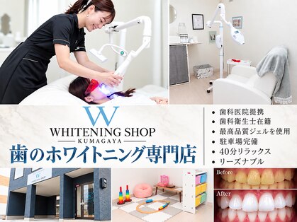 ホワイトニングショップ 熊谷店の写真