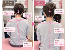 ボディステップ(BODY STEP)の雰囲気（40代/女性/猫背/頭痛）