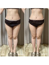 マインドプラス(mind plus)/1回でこの効果！！