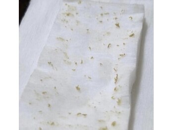 ミラーヴ(MERAVE)/取れた角栓が見れるのも特徴！