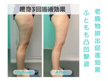 ナナ 銀座(Nana)/体の老廃物排出促進効果