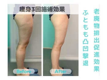 ナナ 銀座(Nana)/体の老廃物排出促進効果