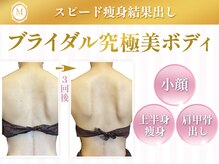 ミント(Mint)の雰囲気(フォースカッター痩身×肩甲骨出し整体で洗練された背中美へ♪)