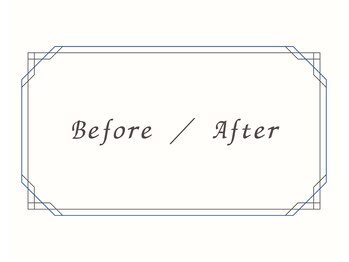 ヨサパーク リノ(YOSA PARK Lino)/Before/After［痩身/リンパ］