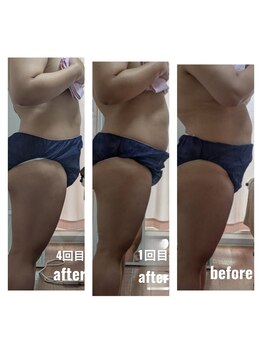 紬(TSUMUGI)/反り腰は戻ります