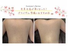 ブリス 渋谷駅前(BliSS)/ハーブピーリング|ブライダル