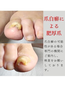 《施術不可能な場合の参考例》