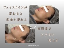 ジュジュ(juju)/異物を入れ続けますか？