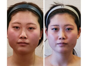 金梨花サロンの写真/日常の癖や歯ぎしり/食い縛りによる顔の歪みに！【脳頭蓋&小顔頭蓋の同時解放は最高小顔効果が得られます】