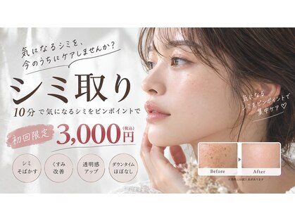 ベルーナ(Belluna)の写真