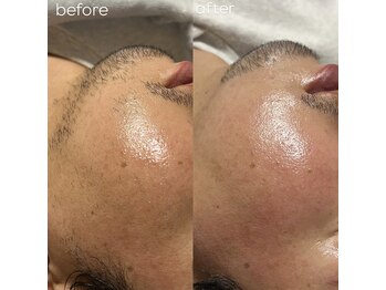 アイリー(IRIE)/肌が綺麗になるフェイスワックス