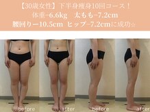 エターナルフレーム(Eternal Flame)/30歳下半身集中スリム