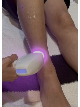 パーツ脱毛のできるサロン