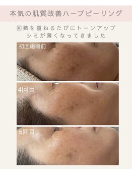 ティアラ(Tiara)/