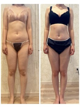 エストシード(est.seed)/バストアップコース