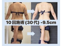 ビヒトジャパン 町田相模原の雰囲気（お腹もスパルタ!! 次はあなたの番です!!【町田痩身】）