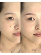 プール 鹿児島中央駅店(POOL)/HBL