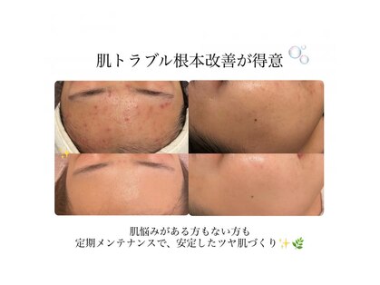 エクラ(eclat)の写真