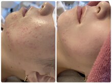 クオーレ 福津(cuore)の雰囲気（ハーブピーリングで肌質改善！美白効果も抜群）