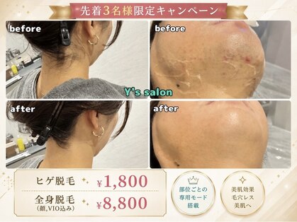 ワイズサロン(Y's salon)の写真