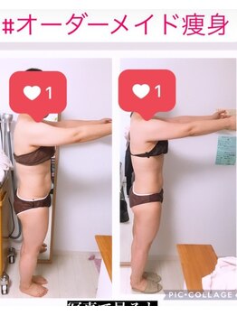 ビューティーチャージ(BeautyCharge)/beforeafter 30代