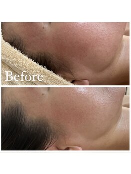 ルルボーテ(Loulou Beaute)/クリスティーナ/アンストレス