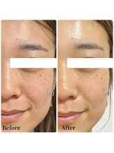 エース(ACE.)/肌のツヤ、透明感アップ☆