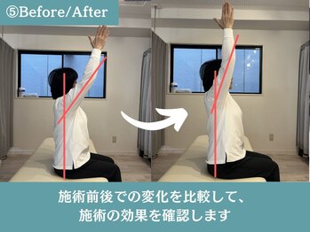 ピーボディ 神戸三宮院(P-body)/Before/After