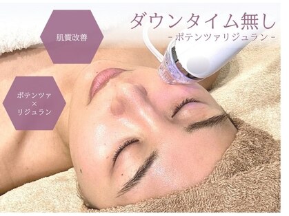 ビアル(VIALU)の写真