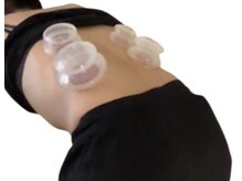 ロサ ケンティフォリア(Rosa centifolia)