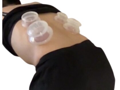 ロサ ケンティフォリア(Rosa centifolia)の写真