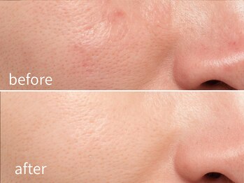 ソレイユ(Soleil)/透明感・ハリ