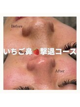 レア(Lea)/イチゴ鼻を卒業しましょう＊