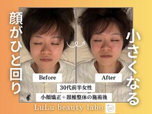 ルルラボ(LuLu beauty labo)/顔をひと回り小さく◎