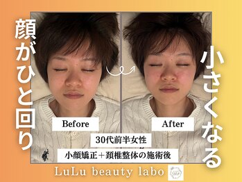 ルルラボ(LuLu beauty labo)/顔をひと回り小さく◎
