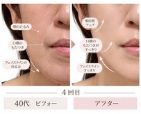 リアン(Lien)